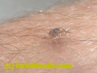 /home//u458753944/public_html/sourcegallery//////////////////////////////////////Insects and small critters/beetles (Coleoptera)/P1140147.JPG